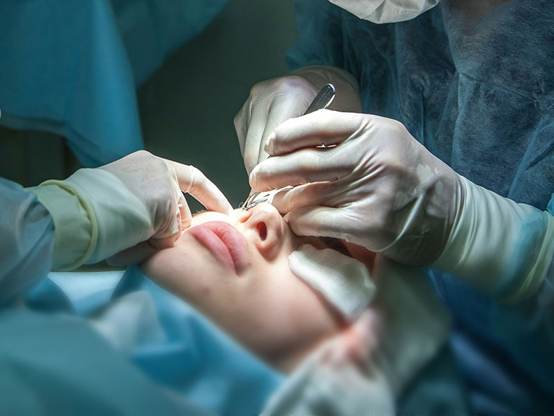 A Spectrum of Bespoke Lifting Solutions